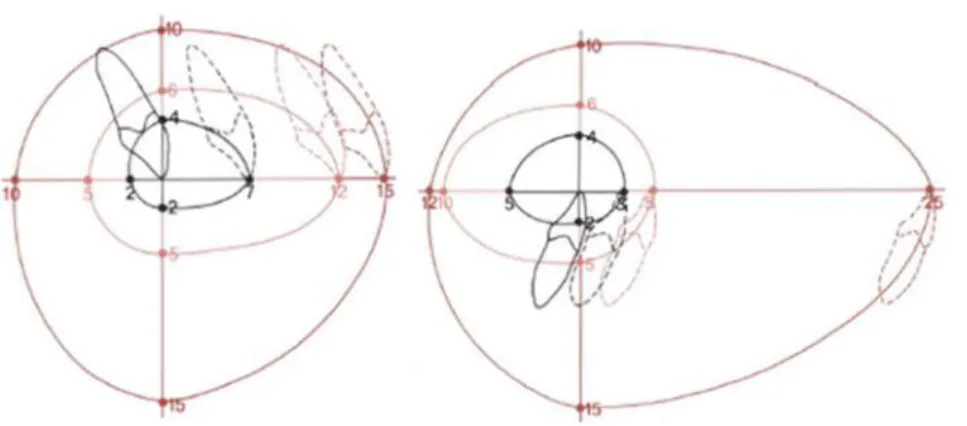 Figure 3. ”Envelope of discrepancy” shows the amount of change of tooth position that could be  produced by orthodontic tooth movement alone, orthodontic tooth movement combined with  growth modification, and orthognathic surgery