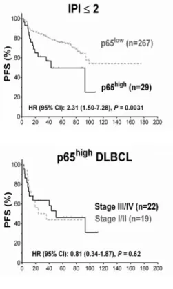 Figure  2.  Prognosis  for  p65  hyperactivation in diffuse  large  B‐cell  lymphoma  (DLBCL).  (A)  In  overall  DLBCL,  high  p65 nuclear expression (p65 high , ≥50% nuclear expression) was associated with unfavorable progression‐free survival (PFS). The