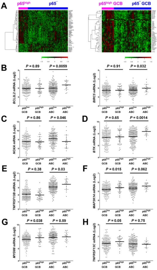 Figure 3. Gene expression profiling analysis.  (A)  Heatmaps  for  comparisons  between  DLBCL  patients  with  p65 high  expression (IHC