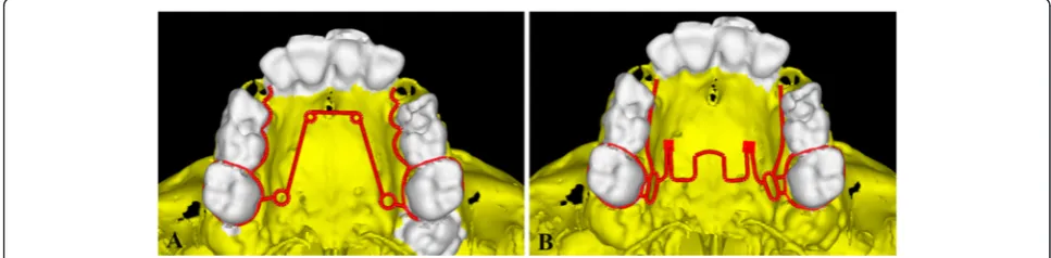 Fig. 1 Schematic representation of the a quad-helix appliance model and b NPE2 appliance model
