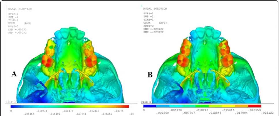 Table 3 Mid-palatal suture displacement (mm) after activation of quad-helix and NPE2