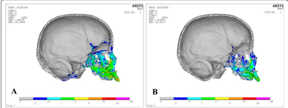 Fig. 4 Stress distribution in the frontal view after activation of the expansion device