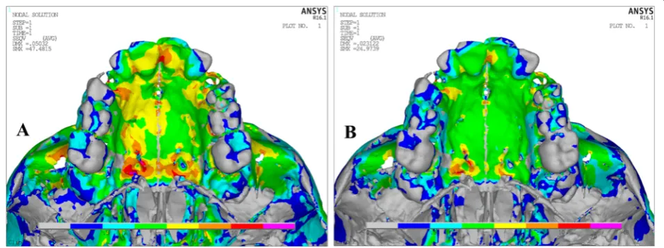Fig. 6 Stress distribution in the lateral view after activation of the expansion device