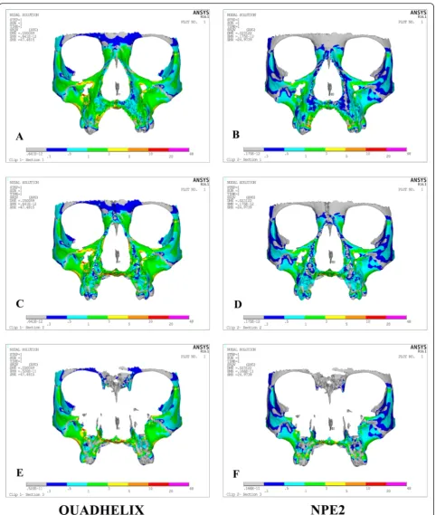 Fig. 8 Stress distribution after activation of the quad-helix and NPE2 models in the cross-sectional view at the first deciduous molar (a, b), seconddeciduous molar (c, d), and first permanent molar (e, f)