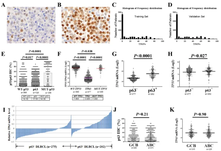 Figure  1.   p63  expression  in  diffuse  large  B‐cell  lymphoma  (DLBCL)  in  comparison  with  p53  expression