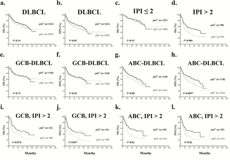 Figure 3. Prognostic analysis of p63 expression in DLBCL.  (a‐b) p63 expression correlated with significantly better progression‐free survival  (PFS)  but  not  overall  survival  (OS)  in  DLBCL.  (c‐d)  p63  expression  correlated  with  significantly  b