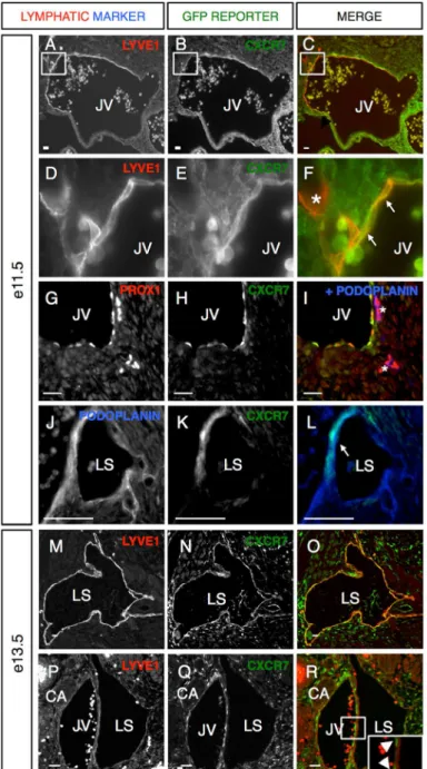 Figure 2-2. Cxcr7 is dynamically expressed in lymphatic endothelium during  development