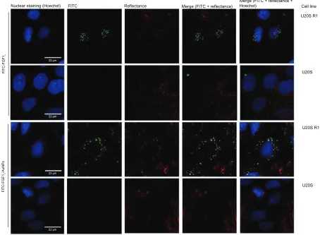 Figure 5 Receptor-specific internalization of FGF1V or FGF1V-AuNPs visualized with confocal fluorescence microscopy.Notes: U20S R1 and U20S cells were incubated with fluorescently labeled FGF1V-AuNPs (FITC, FGF1V-AuNPs), and fluorescently labeled FGF1V (FI
