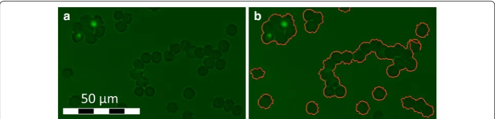 Fig. 7 Cell density error. a Original image: the cell density is so high, that the non parasitized RBC are in contact and cannot be distinguished by the algorithm