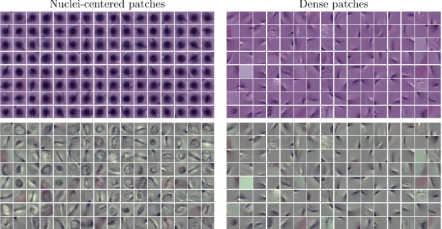 Figure 2.4: Subset of elements from unsupervised dictionary learning framework. Top row: