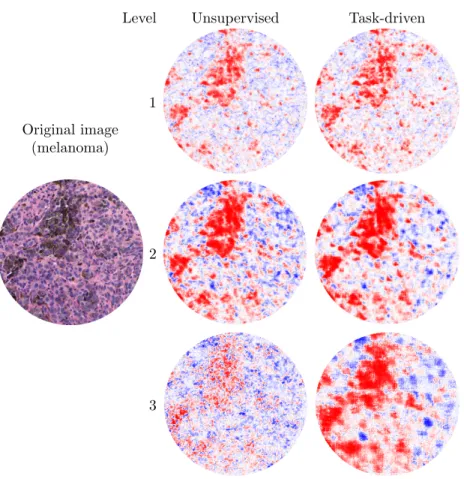 Figure 2.5: Relevance maps for a sample image: red indicates features associated with melanoma; blue indicates benign nevi.