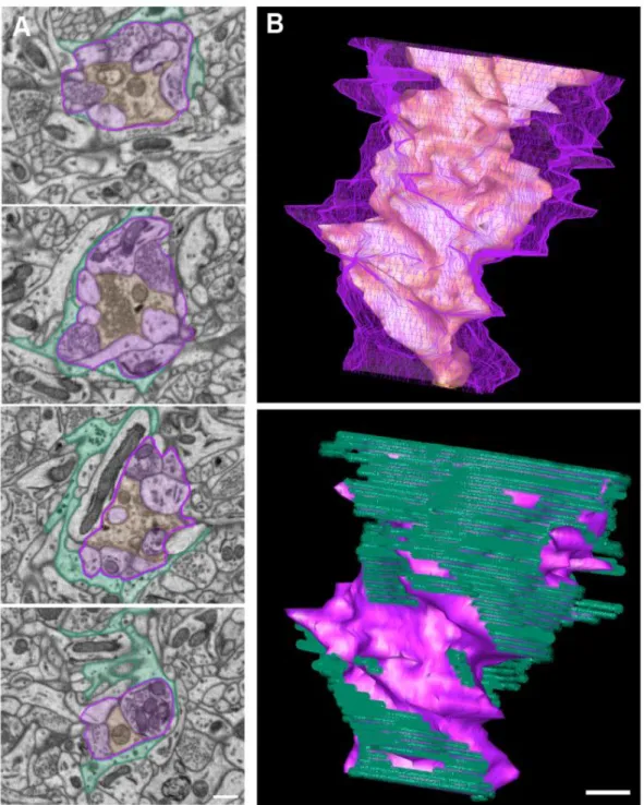Figure 1. An example of a C1-type terminal forming a glomerular synapse. The  images were pseudocolored to identify the primary afferent (orange), the glomerular 