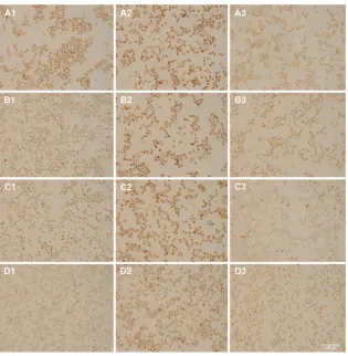 Figure 7 Pseudo-in situ polymerase chain reaction performed with nanobarcoded superparamagnetic iron oxide nanoparticles (NB-SPIONs)