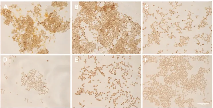 Figure 9 In situ polymerase chain reaction (ISPCr) on samples that were incubated with nanobarcoded superparamagnetic iron oxide nanoparticles at (A) 200 nM,  (B) 50 nM, (C) 25 nM, or (D) 0 final concentrations for 24 hours