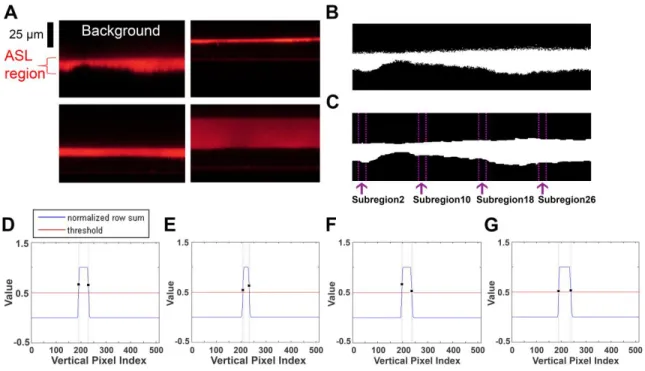 Figure  2.1.  Initial  processing  of  confocal  micrographs  using  Otsu’s  threshold