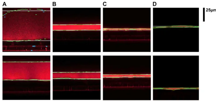 Figure 2.5. Examples of the detected boundaries of different ASL regions obtained from the  test image set