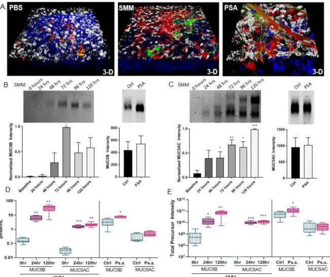 Figure 1.1. CF cell culture models exhibit mucus hypersecretion and adhesion of  mucus to surface