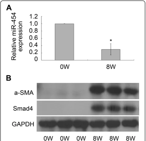 Figure 6 miR-454 was down-regulated inand Smad4 expression were all up-regulated in the fibrotic liversinfected with S