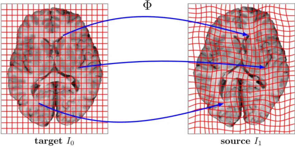 Figure 2.1: Spatial correspondence of two brain images. The space transformation Φ maps the coordinates of the target image to the corresponding anatomical coordinates of the source image