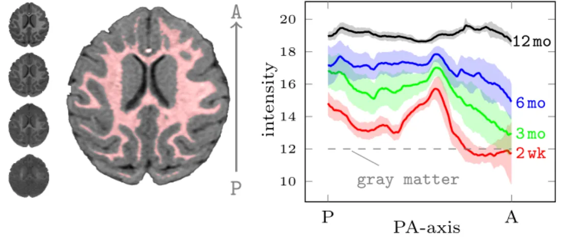 Figure 3.5: Spatiotemporal distribution of white matter intensities in 9 monkeys. A single slice from each time point is shown in order in the left column (2 week at the bottom), and the white matter segmentation (red) at 12 months is shown in the middle