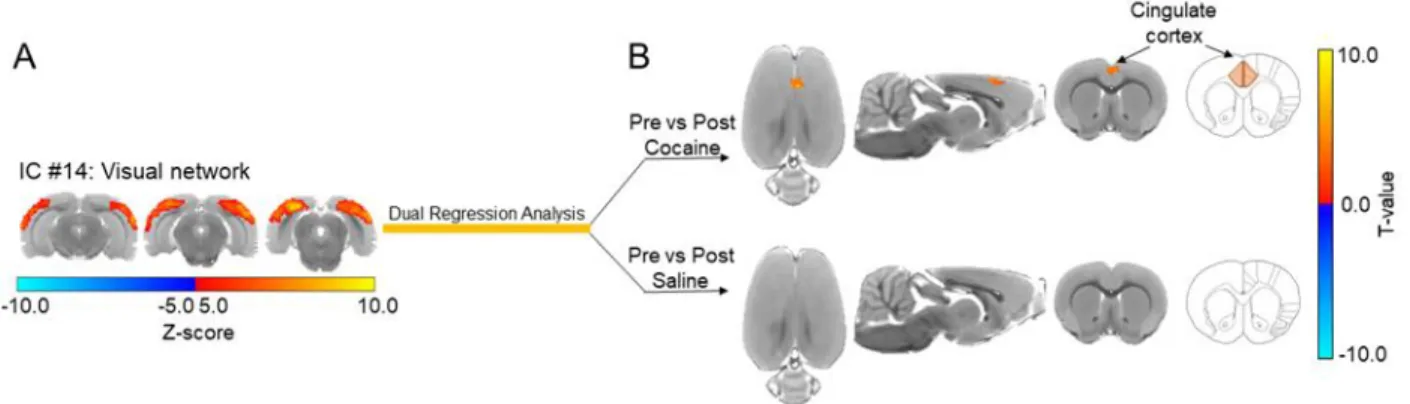 Figure 3.2: Resting state networks derived from the multi-subject ICA analysis.  