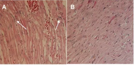 Figure 10 The inhibition rate of drug-loaded nanoparticles to breast cancer in mouse models.