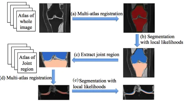 Figure 1.2: Cartilage segmentation pipeline. (a) Multi-atlas registration to compute the spatial prior for the bone