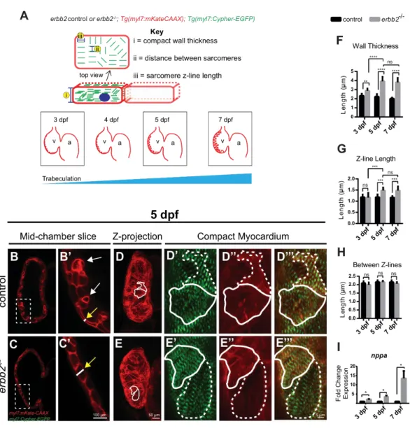 Figure 5 erbb2 mutant develops HL phenotypes 