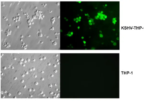 Figure 1: KSHV infection in THP1 cells. Fluorescence microscopy of GFP expression in KSHV- KSHV-THP-1 cells (top panel) compared to uninfected KSHV-THP-1 control cells (bottom panel)