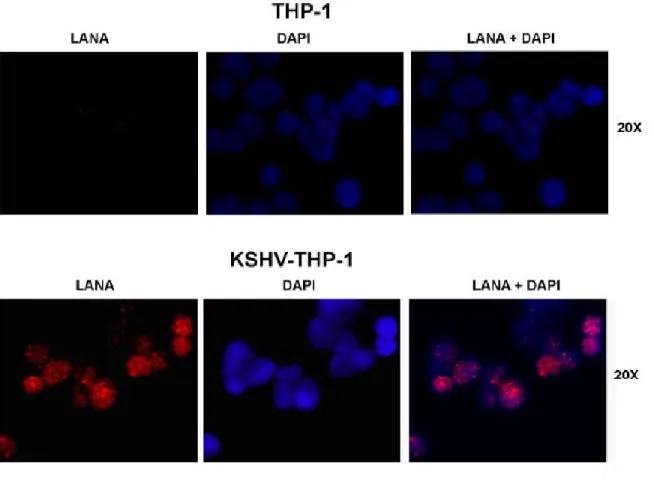 Figure 3: Expression of KSHV LANA by immunofluorescence staining in KSHV-THP-1  compared to uninfected THP-1 cells