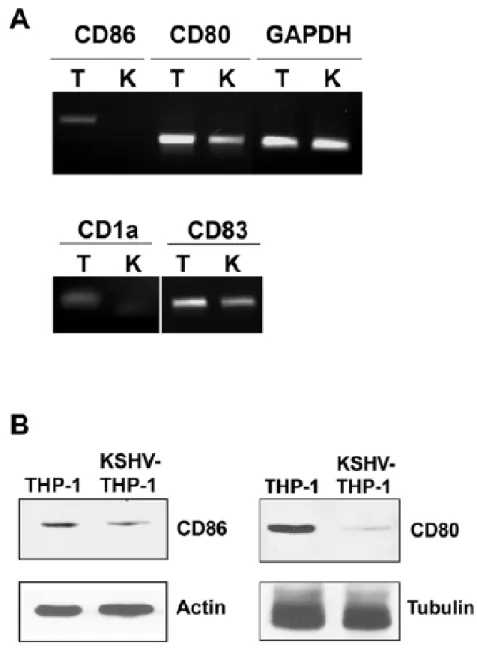Figure 5: Latent KSHV inhibits expression of costimulatory molecules. (A) qPCR analysis for  expression of CD86, CD80, CD83, and CD1a in KSHV-THP-1 cells compared to uninfected THP-1  control cells (B) Expression of CD86 and CD80 were determined by immunob