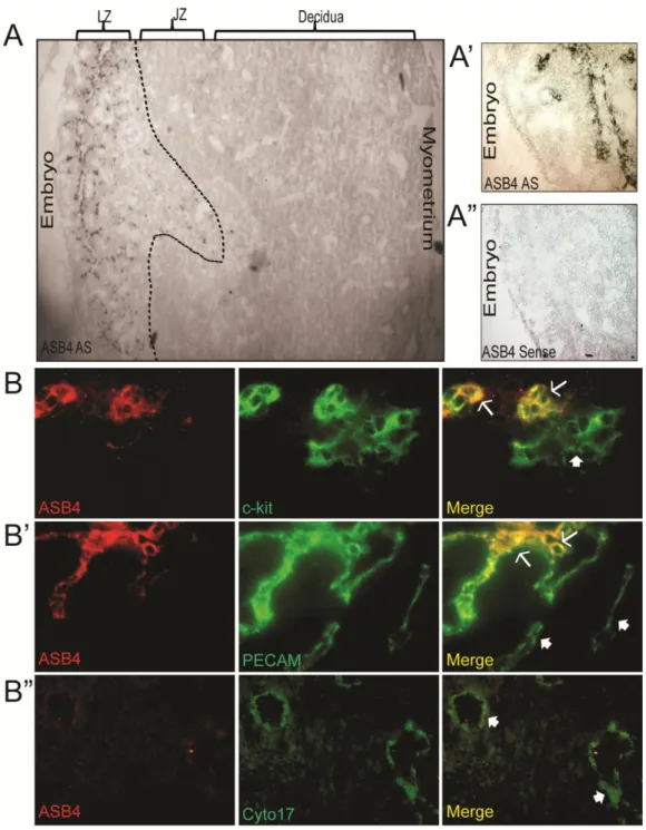 Figure 2.1. ASB4 is expressed in the developing placental vasculature.  
