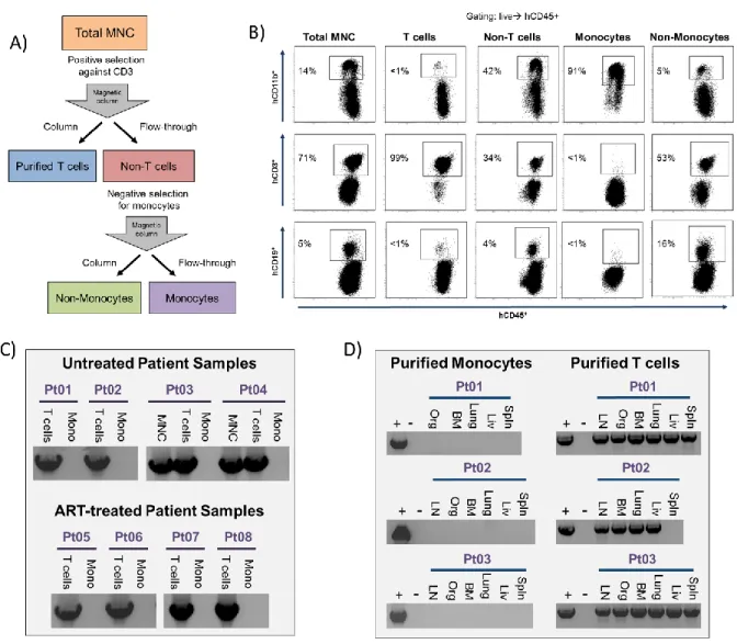 Figure 3.1: Absence of HIV DNA in monocytes but not in T cells isolated from  peripheral blood of infected patients