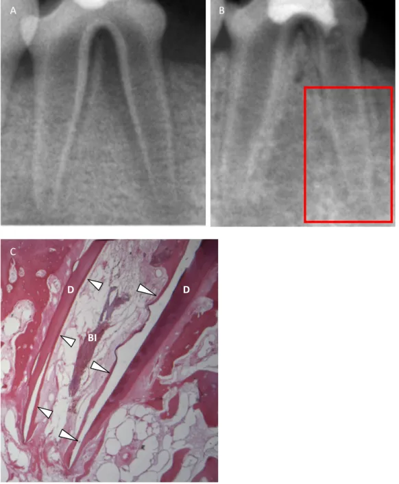 Figure 1. Example of group with induced bleeding only (Group B). (A) Pre and (B) post 