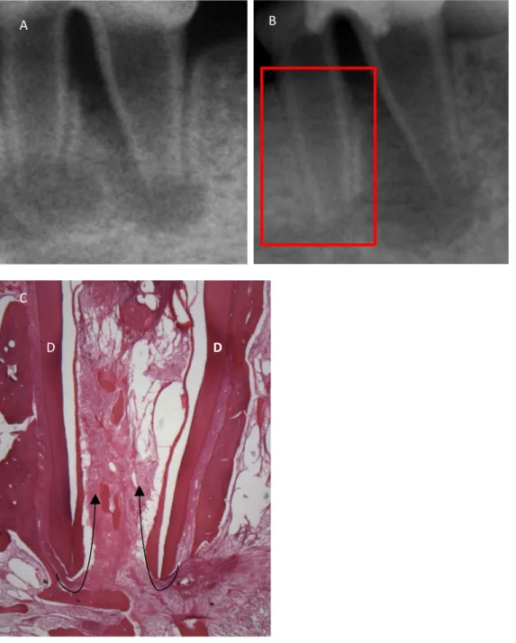 Figure 2. Example of group with 17% EDTA treatment and induced bleeding (Group BE). (A) Pre  and (B) post operative radiographs
