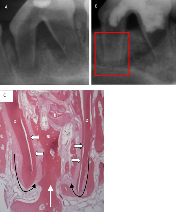 Figure 4. Group with 17% EDTA, induced bleeding, and cross-linked collagen scaffold (Group  BES)