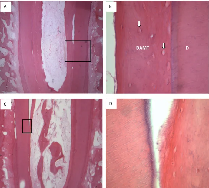 Figure 10. Thickening of the root wall with DAMT and the effects of partial exposure of the dentin  matrix with 17% EDTA
