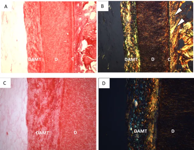 Figure 1. PSR staining of deposition of DAMT on inner dentin wall (D). (A) DAMT and dentin  wall shown in PSR staining in bleeding+EDTA+scaffold (BES) group
