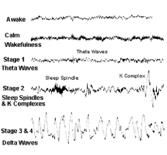 Figure 1. Example of EEG waves for each stage of sleep 