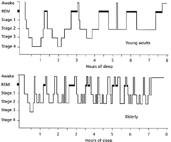 Figure 2. Example of younger adults’ sleep architecture (top), and older adults’ sleep  architecture (bottom), (http://www.aafp.org/afp/990501ap/2551.html)