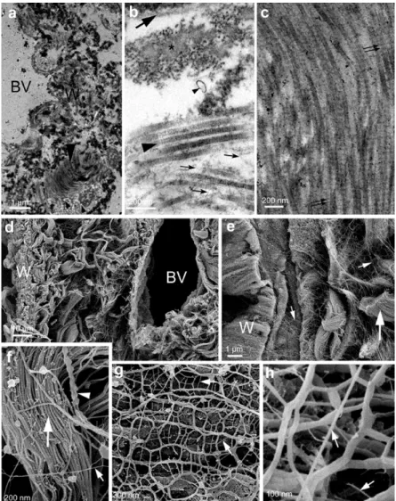 Figure 10: Biomatrix scaffolds prepared by gentle delipidation  and high salt buffer washes
