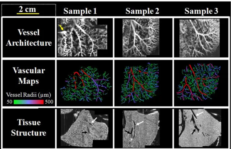 Figure 13. A compilation of image data acquired of the three biomatrix scaffold samples