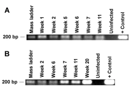 Figure 4PCR detection of HIV-1 in infected RAG-hu micePCR detection of HIV-1 in infected RAG-hu mice