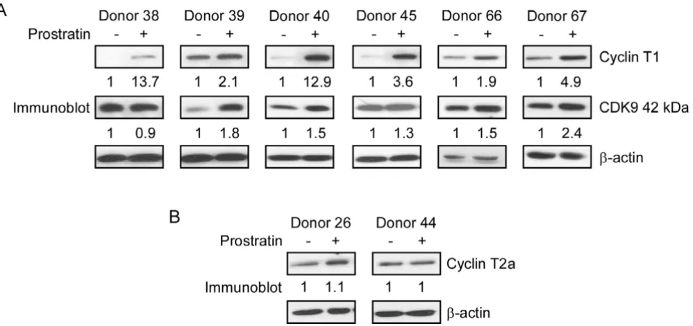Figure 2Effects of prostratin on the expression levels of Cyclin T1, Cyclin T2a, and CDK9examine the levels of Cyclin T1, CDK9, Effects of prostratin on the expression levels of Cyclin T1, Cyclin T2a, and CDK9