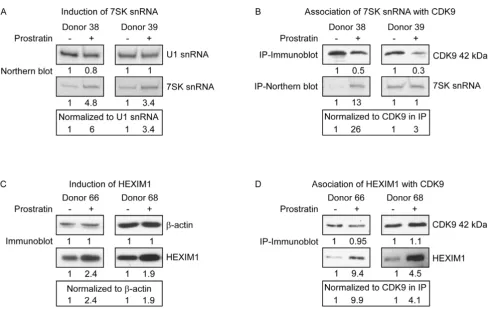 Figure 3Levels of 7SK snRNA and HEXIM1 and association with P-TEFbperformed using antiserum against CDK9 with extracts adjusted to precipitate equivalent amount of CDK9