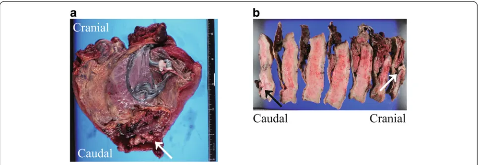 Fig. 2 Macroscopic findings in the surgical specimen. a The image shows gross findings in the uterus, which was resected due to placentaaccreta spectrum