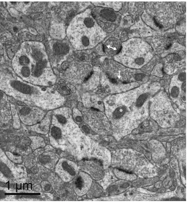 Figure 2. Transmission electron microscopy (TEM) was used to assess changes in  synaptic density after chronic haloperidol treatment