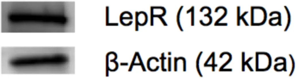 Figure 6. This western blot shows both leptin receptor and β-actin. Proteins were identified using  a protein ladder for reference