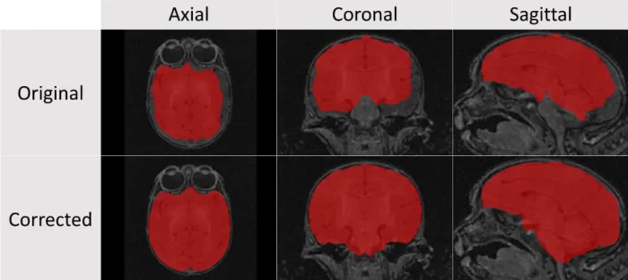 Figure 5. A representative case of the manual corrections performed to the automatically generated brain masks in a two-week  old macaque