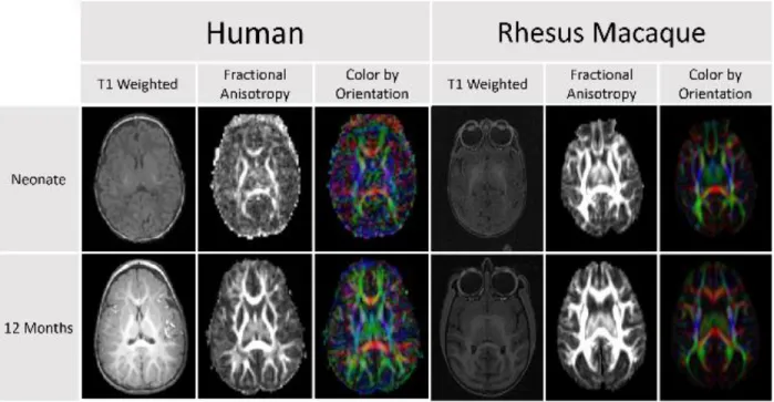 Figure 1. Comparison of DTI scans for humans and rhesus macaques demonstrates that diffusion anisotropy is observable before  a clear distinction between the white and gray matter is visible in the T1 weighted image